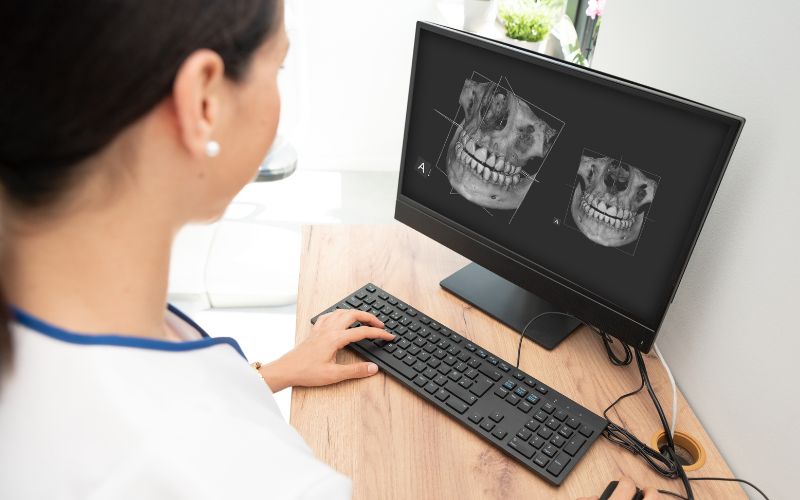 Çene Cerrahisi: İhtiyaç Duyduğunuz Özel Bakım